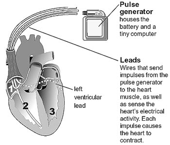 The CRT Device